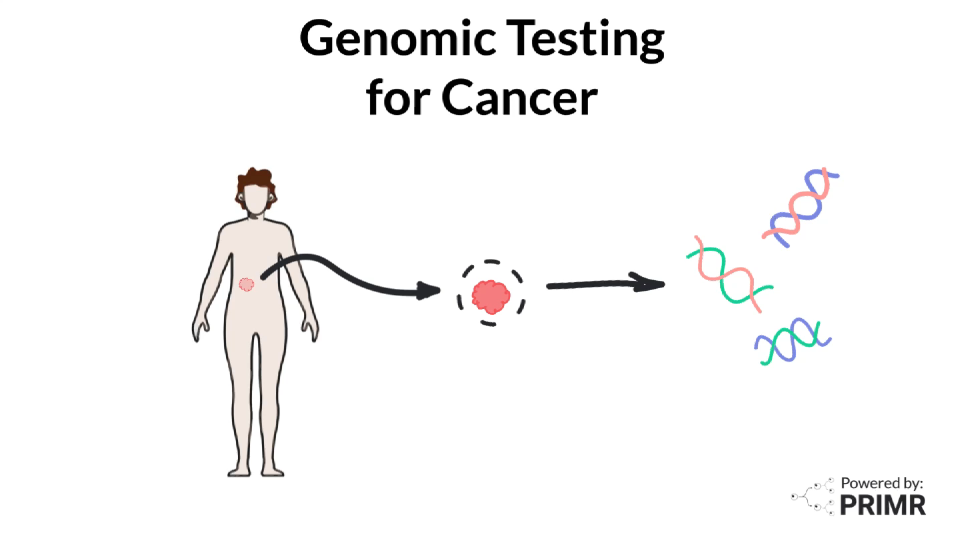 primr-anatomy-for-breast-cancer-treatment